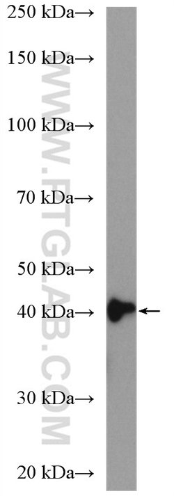 ACADL Rabbit anti-Human, Mouse, Rat, Polyclonal, Proteintech:Antibodies:Primary