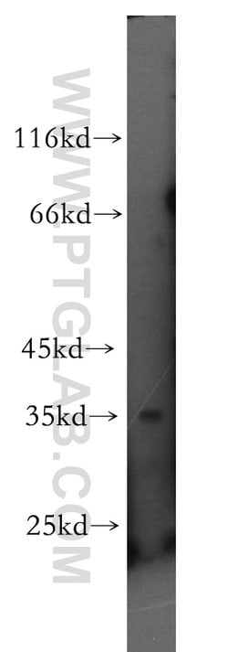 RNASEH2B Rabbit anti-Human, Mouse, Rat, Polyclonal, Proteintech:Antibodies:Primary