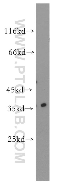 RNASEH2B Rabbit anti-Human, Mouse, Rat, Polyclonal, Proteintech:Antibodies:Primary
