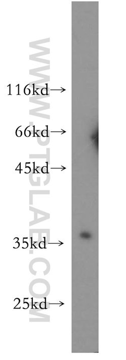 RNASEH2B Rabbit anti-Human, Mouse, Rat, Polyclonal, Proteintech:Antibodies:Primary