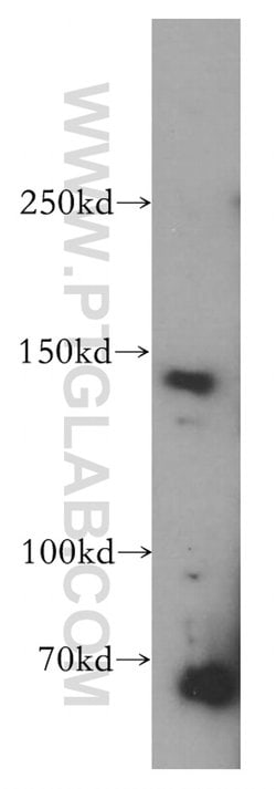 POLR3A Rabbit anti-Human, Mouse, Rat, Polyclonal, Proteintech 20 &mu;L;