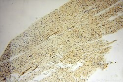 DNAI2 Rabbit anti-Human, Mouse, Rat, Polyclonal, Proteintech 150 &mu;L;