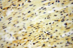 DNAI2 Rabbit anti-Human, Mouse, Rat, Polyclonal, Proteintech 150 &mu;L;