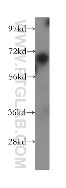 DNAI2 Rabbit anti-Human, Mouse, Rat, Polyclonal, Proteintech 150 &mu;L;