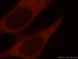 IFT52 Rabbit anti-Canine, Human, Mouse, Rat, Polyclonal, Proteintech:Antibodies:Primary
