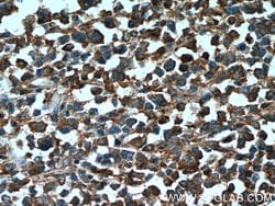 PARP9 Rabbit anti-Human, Rat, Polyclonal, Proteintech 150 &mu;L; Unconjugated:Antibodies,