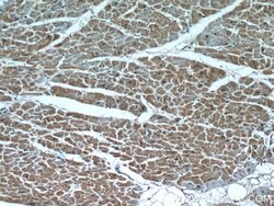 PARP9 Rabbit anti-Human, Rat, Polyclonal, Proteintech 150 &mu;L; Unconjugated:Antibodies,