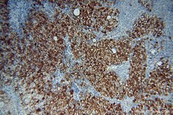 PARP9 Rabbit anti-Human, Rat, Polyclonal, Proteintech 150 &mu;L; Unconjugated:Antibodies,