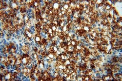 PARP9 Rabbit anti-Human, Rat, Polyclonal, Proteintech 150 &mu;L; Unconjugated:Antibodies,
