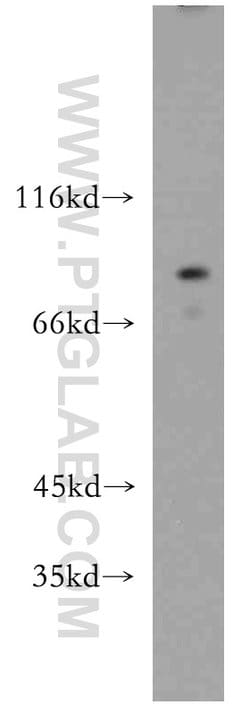 PARP9 Rabbit anti-Human, Rat, Polyclonal, Proteintech 150 &mu;L; Unconjugated:Antibodies,
