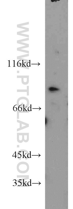 PARP9 Rabbit anti-Human, Rat, Polyclonal, Proteintech 150 &mu;L; Unconjugated:Antibodies,