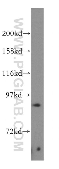 PARP9 Rabbit anti-Human, Rat, Polyclonal, Proteintech 150 &mu;L; Unconjugated:Antibodies,