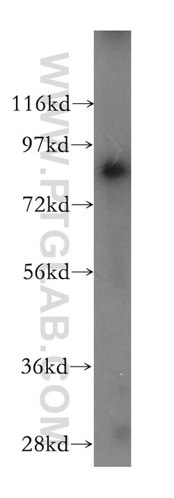 PARP9 Rabbit anti-Human, Rat, Polyclonal, Proteintech 150 &mu;L; Unconjugated:Antibodies,