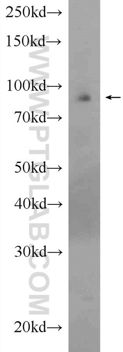 PARP9 Rabbit anti-Human, Rat, Polyclonal, Proteintech 150 &mu;L; Unconjugated:Antibodies,