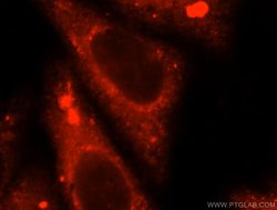 TRMT11 Rabbit anti-Human, Mouse, Rat, Polyclonal, Proteintech:Antibodies:Primary