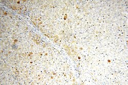 TRMT11 Rabbit anti-Human, Mouse, Rat, Polyclonal, Proteintech:Antibodies:Primary