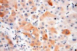 TRMT11 Rabbit anti-Human, Mouse, Rat, Polyclonal, Proteintech:Antibodies:Primary
