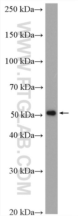 TRMT11 Rabbit anti-Human, Mouse, Rat, Polyclonal, Proteintech:Antibodies:Primary