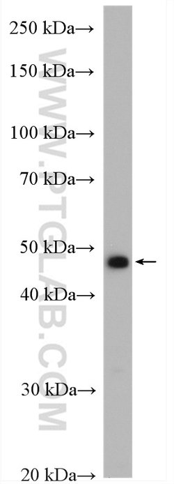 TRMT11 Rabbit anti-Human, Mouse, Rat, Polyclonal, Proteintech:Antibodies:Primary