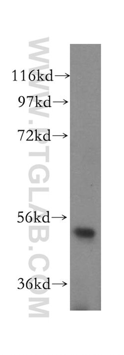 TRMT11 Rabbit anti-Human, Mouse, Rat, Polyclonal, Proteintech:Antibodies:Primary