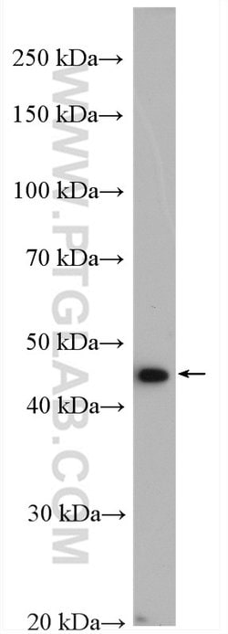 TRMT11 Rabbit anti-Human, Mouse, Rat, Polyclonal, Proteintech:Antibodies:Primary
