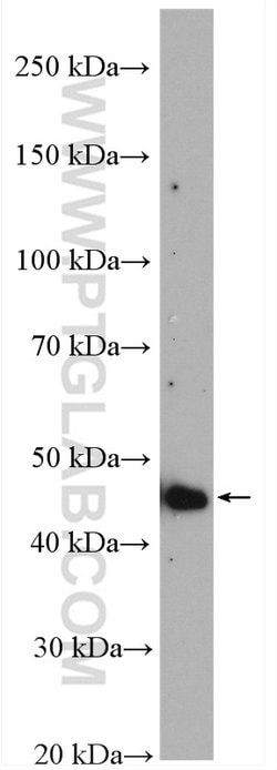 TRMT11 Rabbit anti-Human, Mouse, Rat, Polyclonal, Proteintech:Antibodies:Primary