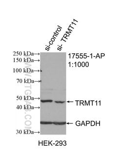 TRMT11 Rabbit anti-Human, Mouse, Rat, Polyclonal, Proteintech:Antibodies:Primary