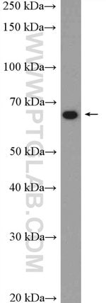 Thumbnail_Sur-8 Rabbit anti-Human, Mouse, Rat, Polyclonal, Proteintech 20 &mu;L;
