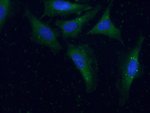 Thumbnail_Sur-8 Rabbit anti-Human, Mouse, Rat, Polyclonal, Proteintech 20 &mu;L;