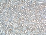 Thumbnail_Sur-8 Rabbit anti-Human, Mouse, Rat, Polyclonal, Proteintech 20 &mu;L;