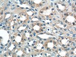 Thumbnail_Sur-8 Rabbit anti-Human, Mouse, Rat, Polyclonal, Proteintech 20 &mu;L;