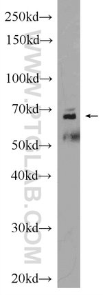 Thumbnail_Sur-8 Rabbit anti-Human, Mouse, Rat, Polyclonal, Proteintech 20 &mu;L;