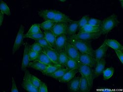 CD146/MCAM Rabbit anti-Human, Mouse, Rat, Polyclonal, Proteintech:Antibodies:Primary