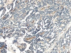 CD146/MCAM Rabbit anti-Human, Mouse, Rat, Polyclonal, Proteintech:Antibodies:Primary