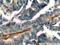 CD146/MCAM Rabbit anti-Human, Mouse, Rat, Polyclonal, Proteintech:Antibodies:Primary