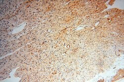 CD146/MCAM Rabbit anti-Human, Mouse, Rat, Polyclonal, Proteintech:Antibodies:Primary