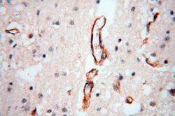 CD146/MCAM Rabbit anti-Human, Mouse, Rat, Polyclonal, Proteintech:Antibodies:Primary