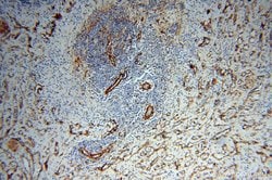 CD146/MCAM Rabbit anti-Human, Mouse, Rat, Polyclonal, Proteintech:Antibodies:Primary