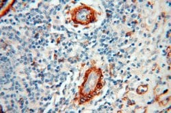 CD146/MCAM Rabbit anti-Human, Mouse, Rat, Polyclonal, Proteintech:Antibodies:Primary