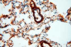CD146/MCAM Rabbit anti-Human, Mouse, Rat, Polyclonal, Proteintech:Antibodies:Primary