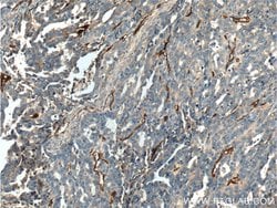 CD146/MCAM Rabbit anti-Human, Mouse, Rat, Polyclonal, Proteintech:Antibodies:Primary