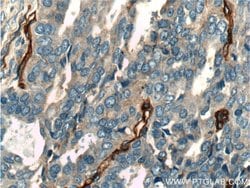 CD146/MCAM Rabbit anti-Human, Mouse, Rat, Polyclonal, Proteintech:Antibodies:Primary