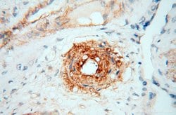 CD146/MCAM Rabbit anti-Human, Mouse, Rat, Polyclonal, Proteintech:Antibodies:Primary