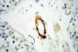 CD146/MCAM Rabbit anti-Human, Mouse, Rat, Polyclonal, Proteintech:Antibodies:Primary