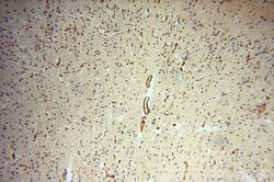 CD146/MCAM Rabbit anti-Human, Mouse, Rat, Polyclonal, Proteintech:Antibodies:Primary