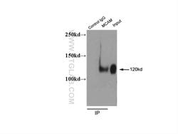 CD146/MCAM Rabbit anti-Human, Mouse, Rat, Polyclonal, Proteintech:Antibodies:Primary