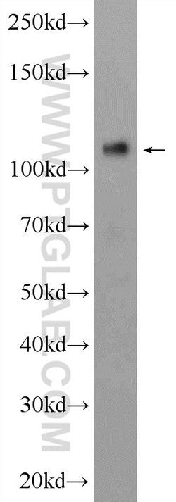 CD146/MCAM Rabbit anti-Human, Mouse, Rat, Polyclonal, Proteintech:Antibodies:Primary