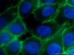 beta-Catenin Rabbit anti-Human, Mouse, Rat, Zebrafish, Polyclonal, Proteintech