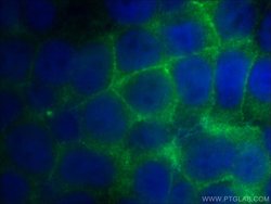 beta-Catenin Rabbit anti-Human, Mouse, Rat, Zebrafish, Polyclonal, Proteintech