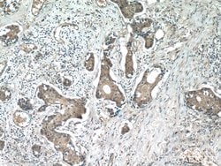 beta-Catenin Rabbit anti-Human, Mouse, Rat, Zebrafish, Polyclonal, Proteintech